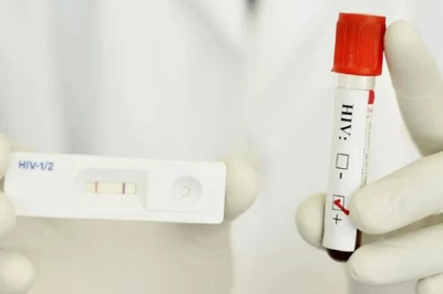 از آزمایش  HIV و تشخیص ایدز چه می‌دانید؟